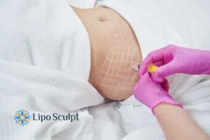 Are The Results From Aqualyx Permanent? 1 Do you want to know how long Aqualyx Canvey Island results last?